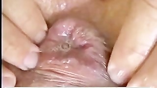 Mature wife extreme fisting